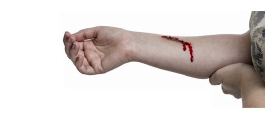 First aid in case of bleeding