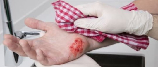 First aid in case of skin wound